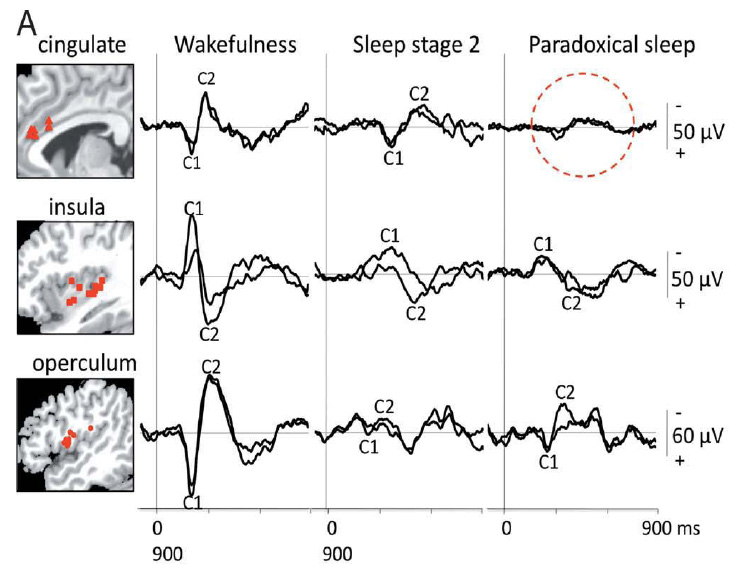 Why is REM sleep also called paradoxical sleep?